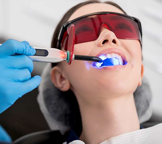 Cary Professional Teeth Whitening