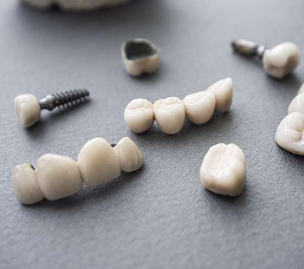 Cary The Difference Between Dental Implants and Mini Dental Implants